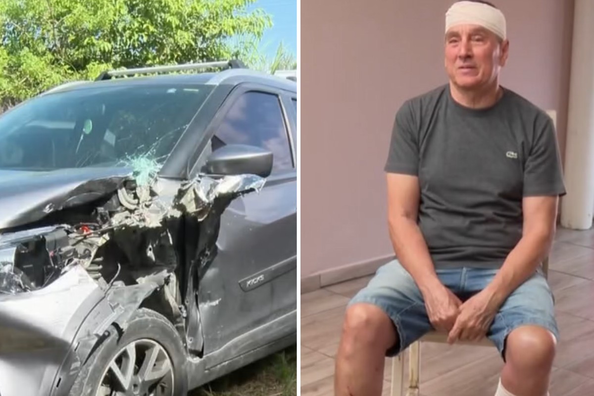 Idoso atropelado por motorista sem CNH em caminhonete furtada desabafa: ‘Nasci de novo’ | Santos e Região