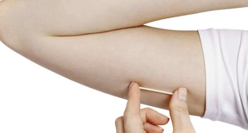 Saúde anuncia que SUS oferecerá implante contraceptivo de alta eficácia