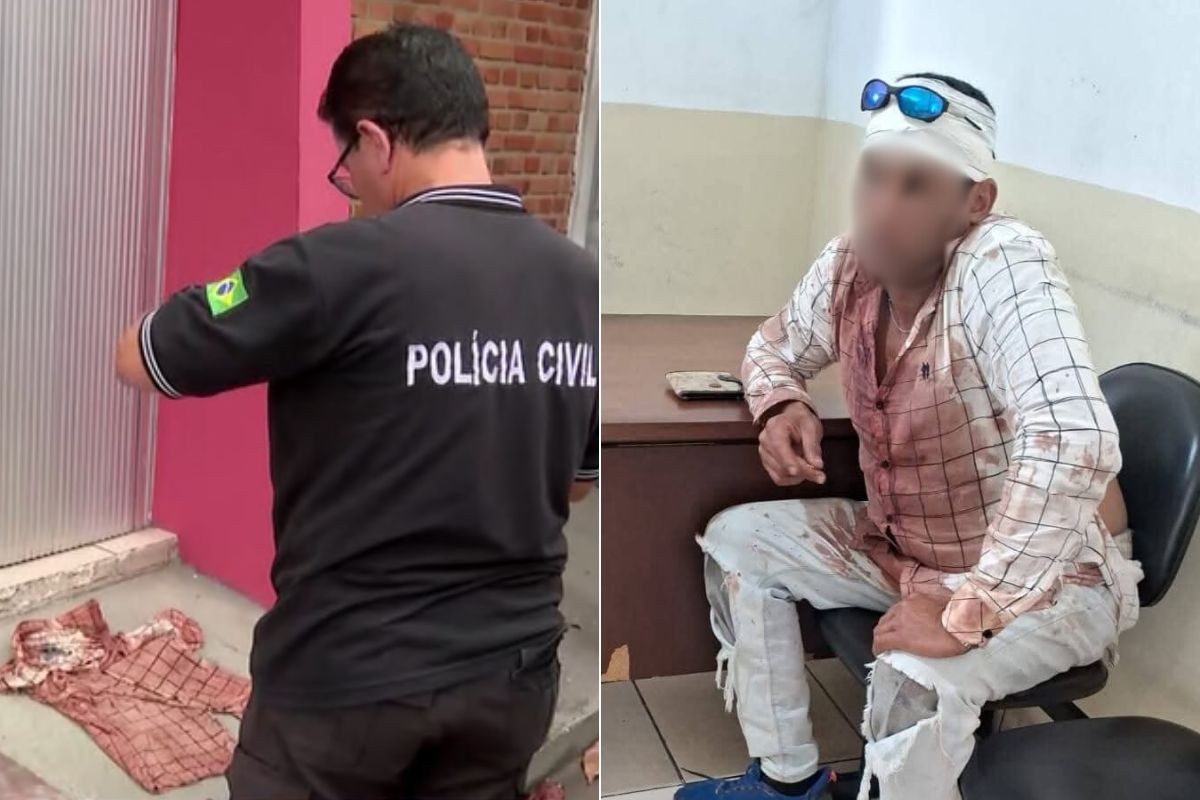Homem em situação de rua diz ter sido agredido por segurança de bar em SP