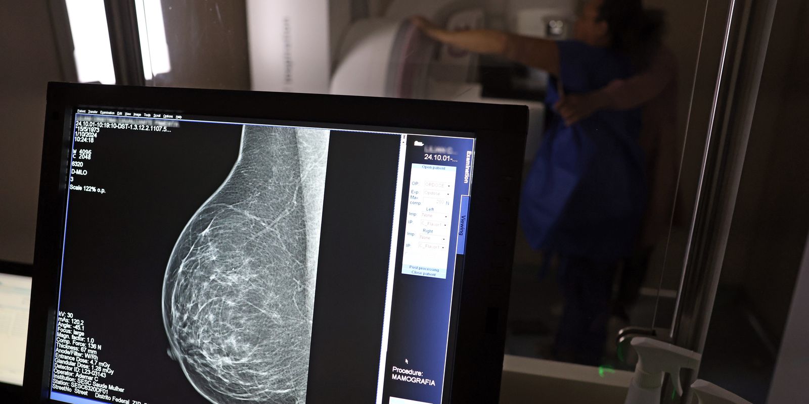Ministério da Saúde passa a recomendar mamografia a partir dos 40 anos