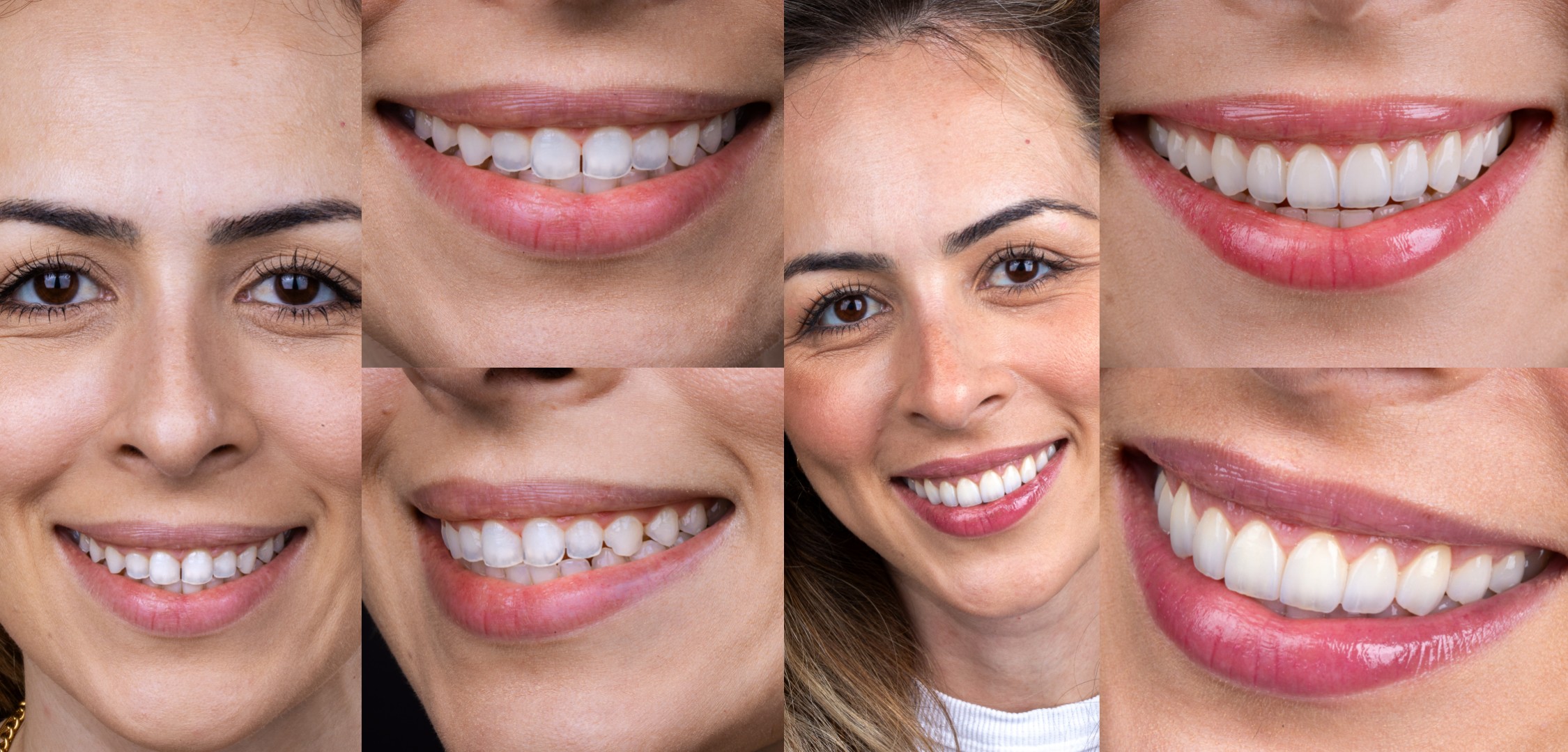 clínica de Santos atrai pacientes do mundo inteiro em busca de sorrisos naturais