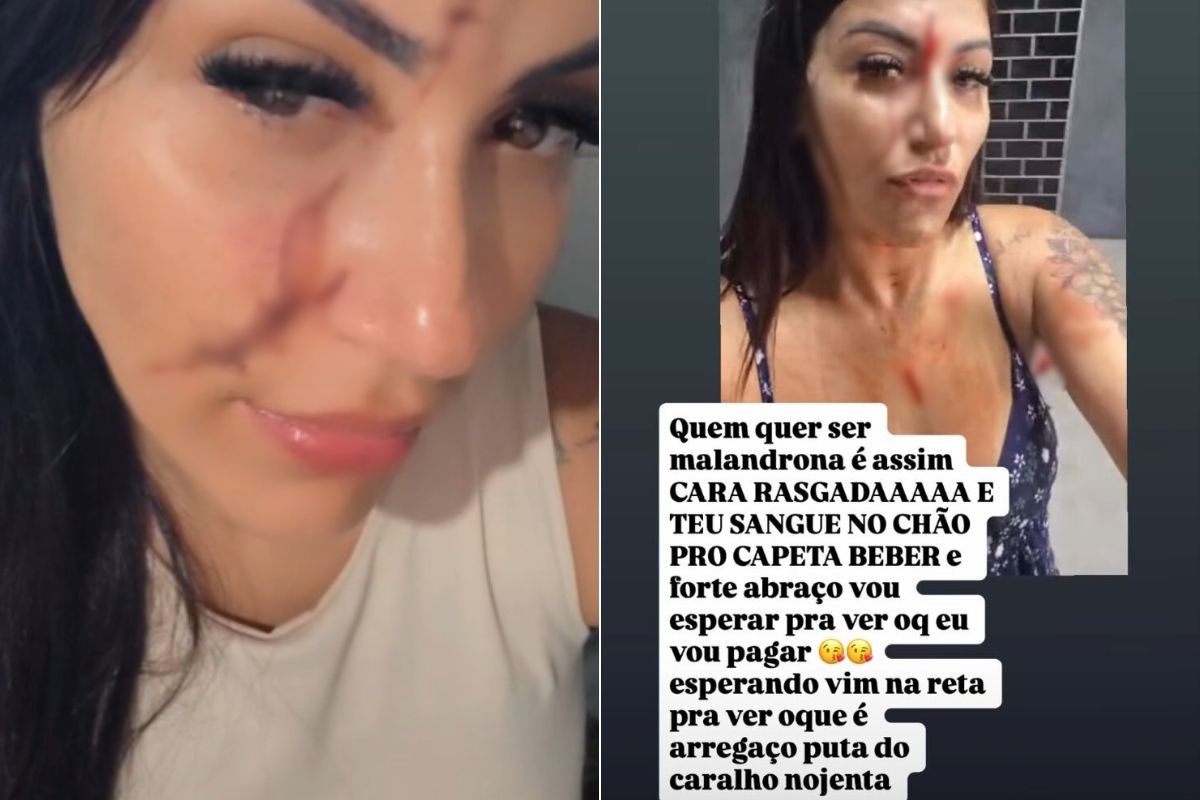 Mulher agride cabeleireira com vidro e debocha: ‘cara rasgada’