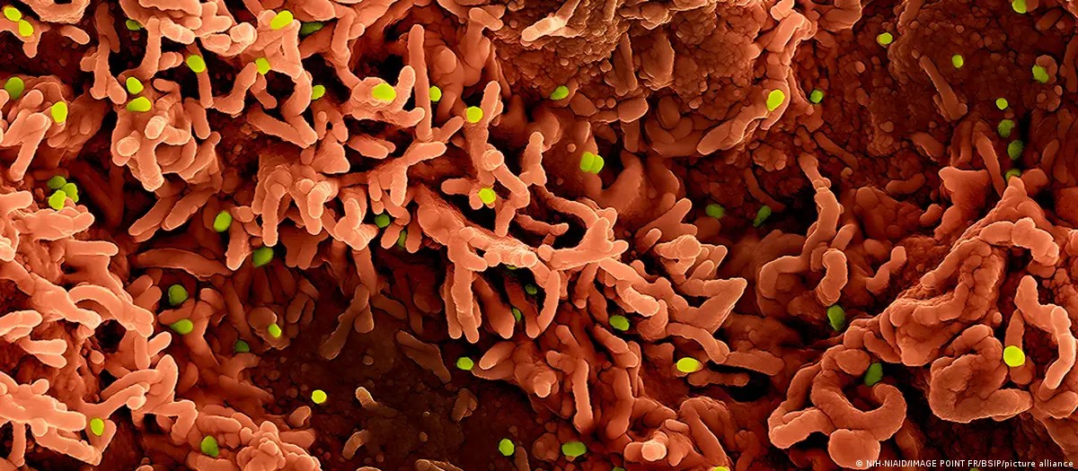 Santos confirma dois casos de mpox; veja sintomas e números em SP