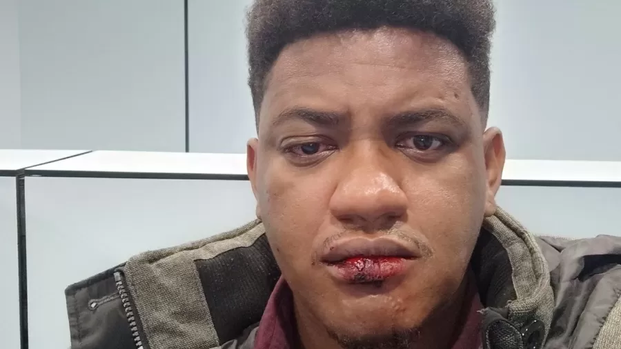 MP de Portugal denuncia três homens por agressão a brasileiros negros