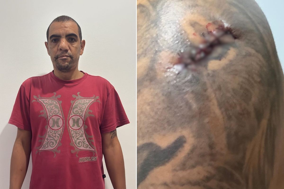 Homem é esfaqueado por assaltante durante passeio com cachorro