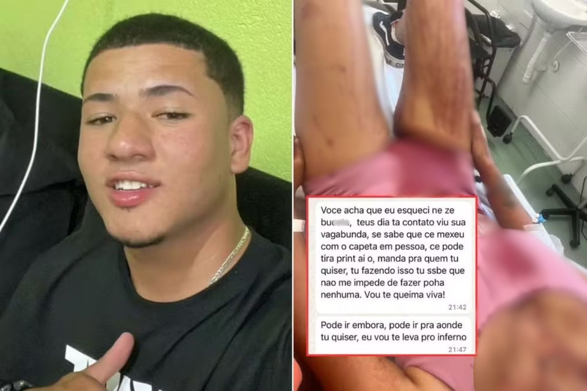 Homem invade casa da ex, leva água fervendo e é preso em hospital