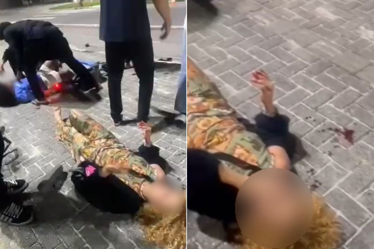 Atropelamento em Guarujá: motorista atinge mulheres em patinete e foge