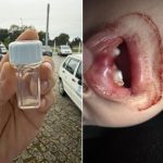 Menino perde dente em queda em creche de Registro (SP)