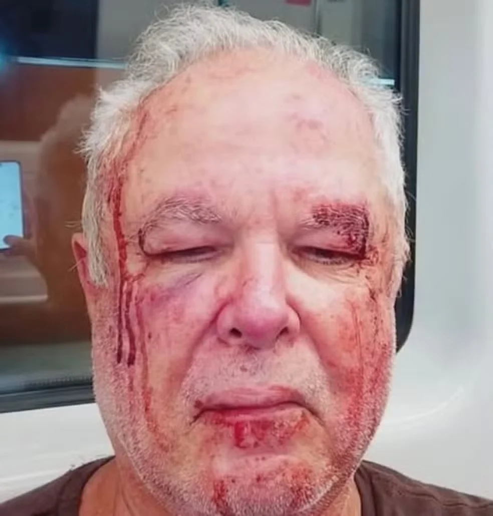 Polícia investiga agressão a idoso por motivação política em Copacabana (RJ)
