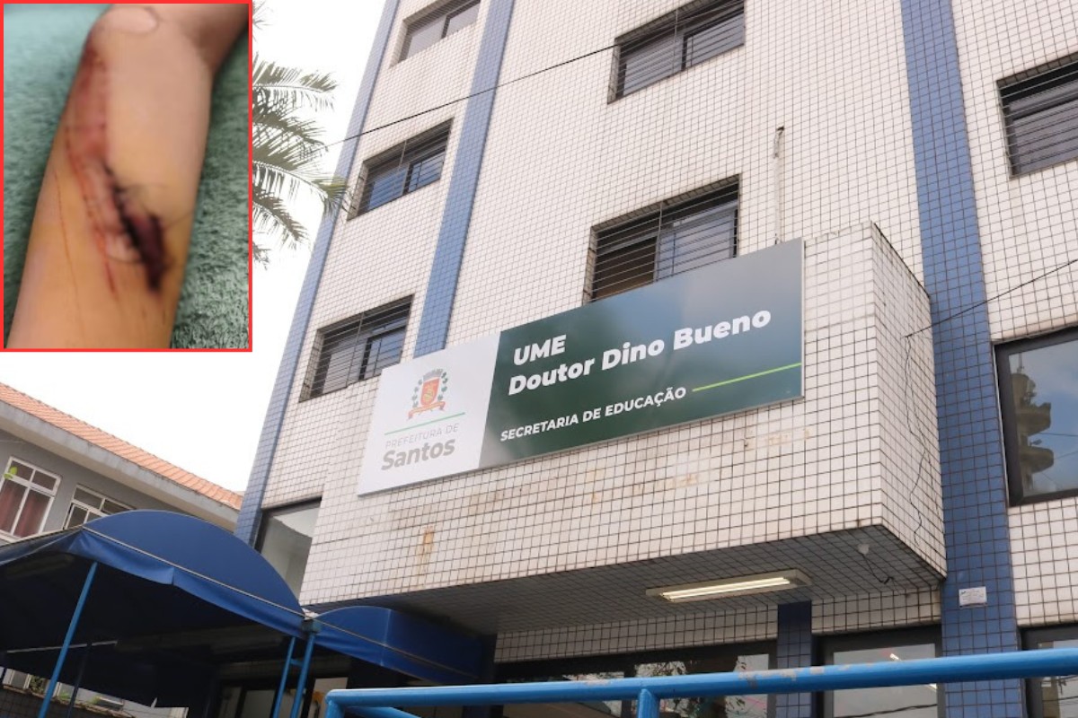 Menino com autismo se corta em escola e família cobra explicações
